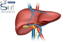 هل يشفى مريض تضخم الكبد